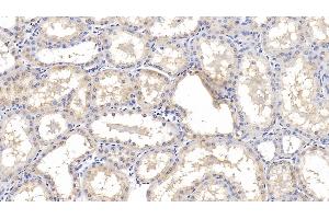 Detection of IL18R1 in Human Kidney Tissue using Monoclonal Antibody to Interleukin 18 Receptor 1 (IL18R1) (IL18R1 Antikörper  (AA 375-428))