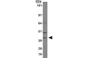 Western blot of ABHD5 in MCF-7 cell lysates using ABHD5 polyclonal antibody . (ABHD5 Antikörper  (AA 200-300))