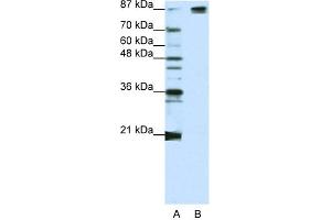 WB Suggested Anti-SF3B1 Antibody Titration:  1. (SF3B1 Antikörper  (Middle Region))