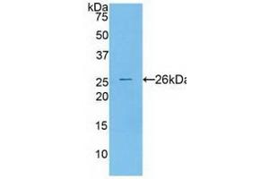 Detection of Recombinant CTSS, Human using Polyclonal Antibody to Cathepsin S (CTSS) (Cathepsin S Antikörper  (AA 115-331))