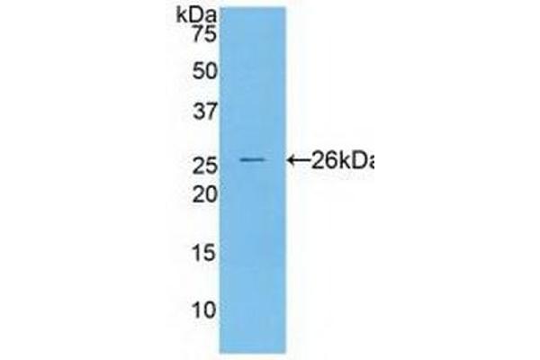 Cathepsin S Antikörper  (AA 115-331)