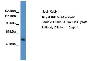 Host:  Rabbit  Target Name:  ZSCAN29  Sample Type:  Jurkat Whole Cell lysates  Antibody Dilution:  1.