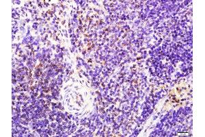 Paraformaldehyde-fixed, paraffin embedded rat spleen tissue, Antigen retrieval by boiling in sodium citrate buffer(pH6) for 15min, Block endogenous peroxidase by 3% hydrogen peroxide for 30 minutes, Blocking buffer (normal goat serum) at 37°C for 20min, Antibody incubation with Rabbit Anti-LAT (Tyr161) Polyclonal Antibody, Unconjugated  at 1:400 overnight at 4°C, followed by a conjugated secondary and DAB staining (LAT Antikörper  (pTyr161))