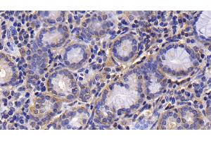 Immunohistochemistry (IHC) image for anti-Phosphoinositide-3-Kinase, Class 2, alpha Polypeptide (PIK3C2A) (AA 172-403) antibody (ABIN7431707)