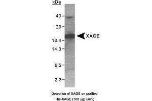 Image no. 1 for anti-X Antigen Family, Member 1D (XAGE1D) antibody (ABIN363336) (XAGE1D Antikörper)