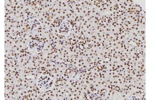 ABIN6276831 at 1/100 staining Rat kidney tissue by IHC-P. (CTBP1 Antikörper  (Internal Region))