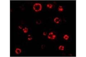 AP20063PU-N ATG16 antibody staining of HeLa Cell Lysate by Immunofluorescence at 4. (ATG16L1 Antikörper  (N-Term))