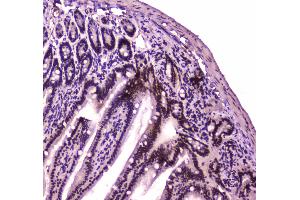 IHC analysis of BRG1 using anti-BRG1 antibody . (SMARCA4 Antikörper  (AA 555-763))
