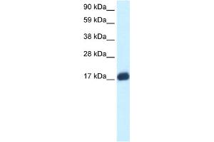 WB Suggested Anti-E2F6 Antibody Titration:  0. (E2F6 Antikörper  (Middle Region))