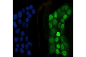 IF analysis of CEBP Beta using anti-CEBP Beta antibody (ABIN3043809).