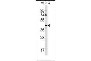 Western blot analysis of GNA14 Antibody (N-term) in MCF-7 cell line lysates (35ug/lane).