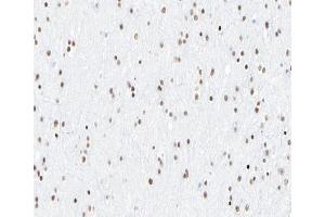 ABIN6267596 at 1/200 staining human brain tissue sections by IHC-P.