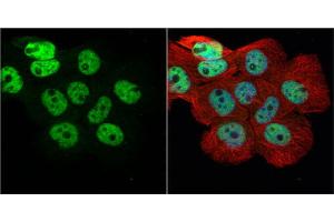 Immunofluorescence (IF) image for anti-Heterogeneous Nuclear Ribonucleoprotein H1 (H) (HNRNPH1) antibody (ABIN2855275)