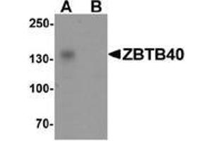 Western blot analysis of ZBTB40 in Raji cell lysate with ZBTB40 Antibody  at 0. (ZBTB40 Antikörper  (N-Term))