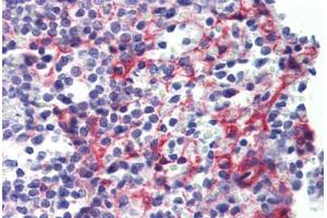 Human Spleen (formalin-fixed, paraffin-embedded) stained with PDGFRB antibody ABIN462353 followed by biotinylated anti-mouse IgG secondary antibody ABIN481714, alkaline phosphatase-streptavidin and chromogen. (PDGFRB Antikörper)