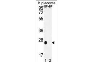 Western blot analysis of OR2J3 Antibody Pab pre-incubated without(lane 1) and with(lane 2) blocking peptide in human placenta tissue lysate. (OR2J3 Antikörper  (C-Term))