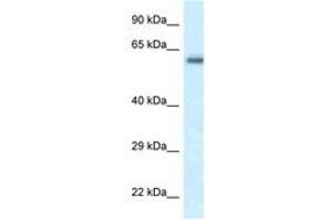 Image no. 1 for anti-FERM Domain Containing 5 (FRMD5) (AA 75-124) antibody (ABIN6747667) (FRMD5 Antikörper  (AA 75-124))