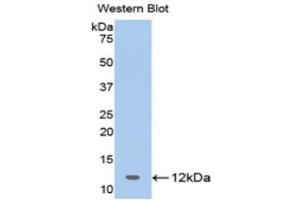 Western Blotting (WB) image for anti-2',5'-Oligoadenylate Synthetase 1, 40/46kDa (OAS1) (AA 74-165) antibody (ABIN3204994) (OAS1 Antikörper  (AA 74-165))