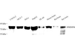 Western blot analysis of HNRNPM (ABIN7074247) at dilution of 1: 3000 (HnRNP M1-M4 Antikörper)