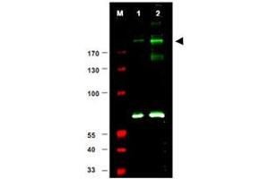 Western blot using IRS1 (phospho S307) polyclonal antibody  shows detection of a band at ~180 KDa believed to represent phosphorylated IRS1 (arrowhead).