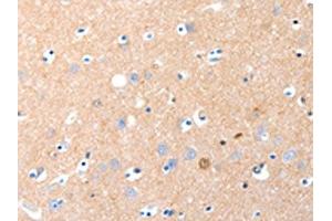 The image on the left is immunohistochemistry of paraffin-embedded Human brain tissue using ABIN7190883(GRM1 Antibody) at dilution 1/15, on the right is treated with synthetic peptide. (Metabotropic Glutamate Receptor 1 Antikörper)