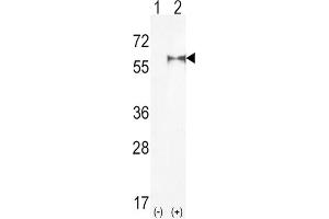 Western Blotting (WB) image for anti-Phosphatidylinositol-4-Phosphate 5-Kinase, Type I, alpha (PIP5K1A) antibody (ABIN3003646) (PIP5K1A Antikörper)