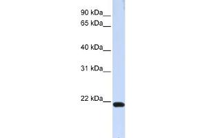 WB Suggested Anti-TJAP1 Antibody Titration:  0. (TJAP1 Antikörper  (N-Term))