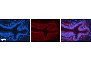 Rabbit Anti-ME1 Antibody     Formalin Fixed Paraffin Embedded Tissue: Human Bronchial Epithelial Tissue  Observed Staining: Cytoplasmic  Primary Antibody Concentration: 1:100  Secondary Antibody: Donkey anti-Rabbit-Cy3  Secondary Antibody Concentration: 1:200  Magnification: 20X  Exposure Time: 0. (ME1 Antikörper  (N-Term))