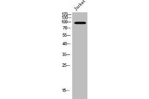 Western Blot analysis of Jurkat cells using EMR1 Polyclonal Antibody (F4/80 Antikörper  (C-Term))