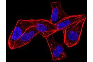 Immunocytochemistry (ICC) image for anti-Aldehyde Dehydrogenase 6 Family, Member A1 (ALDH6A1) (AA 1-195) antibody (ABIN5856297) (ALDH6A1 Antikörper  (AA 1-195))