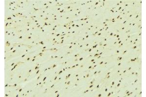 ABIN6276442 at 1/100 staining Mouse brain tissue by IHC-P.