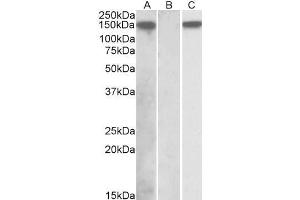 HEK293 lysate (10ug protein in RIPA buffer) overexpressing Human NLRP2 with DYKDDDDK tag probed with ABIN768539 (1ug/ml) in Lane A and probed with anti- DYKDDDDK Tag (1/1000) in lane C. (NLRP2 Antikörper  (C-Term))
