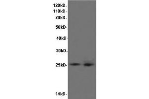 Western Blot analysis of K562 cells and Rat liver tissue using BCL-x Polyclonal Antibody at dilution of 1:600 (BCL2L1 Antikörper)