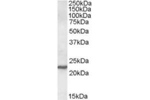 Image no. 1 for anti-SAR1 Homolog A (SAR1A) (Internal Region) antibody (ABIN375021) (SAR1A Antikörper  (Internal Region))