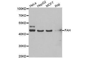 Western blot analysis of extracts of various cell lines, using FAH antibody. (FAH Antikörper  (AA 1-419))