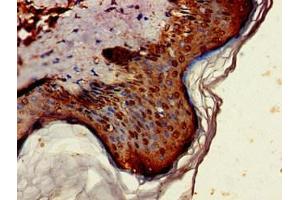 Immunohistochemistry of paraffin-embedded human skin tissue using ABIN7143911 at dilution of 1:100 (ST6GALNAC1 Antikörper  (AA 36-249))