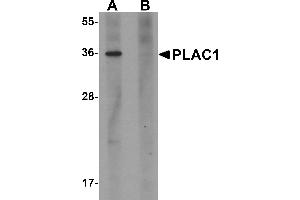 Western Blotting (WB) image for anti-Placenta-Specific 1 (PLAC1) (C-Term) antibody (ABIN1030590)