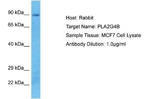 Host: Rabbit Target Name: PLA2G4B Sample Type: MCF7 Whole Cell lysates Antibody Dilution: 1. (PLA2G4B Antikörper  (C-Term))