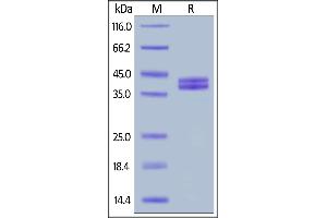 SDS-PAGE (SDS) image for Complement Component 5a (C5a) (AA 679-751) (Active) protein (Fc Tag) (ABIN6938863)