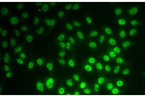 Immunofluorescence analysis of MCF-7 cells using SNRPD1 Polyclonal Antibody (SNRPD1 Antikörper)