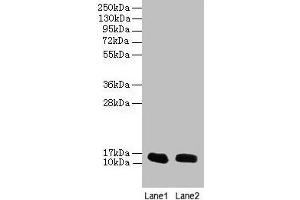 Western blot All lanes: FABP1 antibody at 16 μg/mL Lane 1: Mouse liver tissue Lane 2: Mouse small intestine tissue Secondary Goat polyclonal to rabbit IgG at 1/10000 dilution Predicted band size: 15 kDa Observed band size: 15 kDa