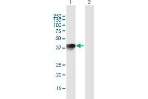 Western Blot analysis of HMX1 expression in transfected 293T cell line by HMX1 MaxPab polyclonal antibody. (HMX1 Antikörper  (AA 1-348))