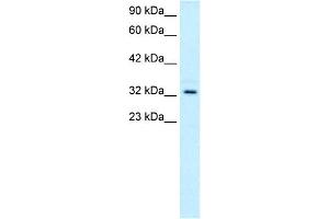 TAL1 anticorps  (C-Term)