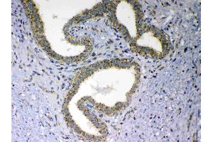 Immunohistochemistry (IHC) image for anti-Mitochondrial Antiviral Signaling Protein (MAVS) (AA 34-96) antibody (ABIN5518935)