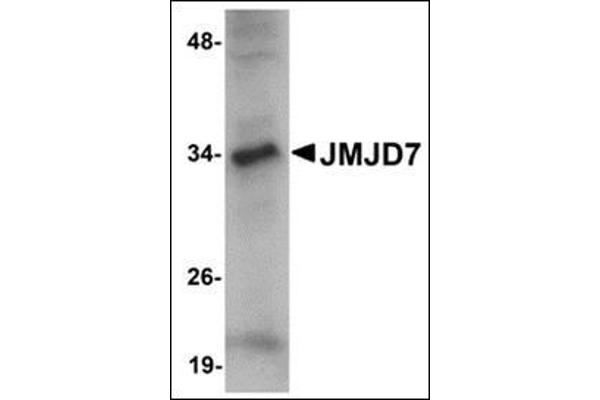 JMJD7 Antikörper  (C-Term)