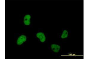 Immunofluorescence of purified MaxPab antibody to MCM7 on HeLa cell. (MCM7 Antikörper  (AA 1-719))