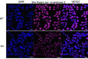 Immunocytochemical staining of HeLa cells using Zinc fingers and homeoboxes 2 antibody (ABIN7800905), 1:1,000), Top panel: wild-type (WT), Bottom panal: Zinc fingers and homeoboxes 2 shRNA knockdown (KD). (Rekombinanter ZHX2 Antikörper)