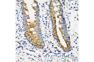Immunohistochemistry (Paraffin-embedded Sections) (IHC (p)) image for anti-Heat Shock 70kDa Protein 9 (Mortalin) (HSPA9) (AA 380-679) antibody (ABIN3021000)