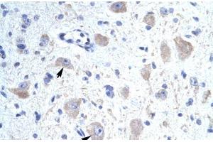 Immunohistochemical staining (Formalin-fixed paraffin-embedded sections) of human brain with KCNIP1 polyclonal antibody . (KCNIP1 Antikörper  (N-Term))