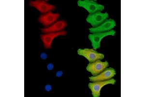 SEPN1 Antibody staining Hela cells by IF/ICC.